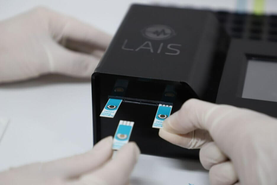 LAIS starts the production of the duo test for syphilis and HIV detection