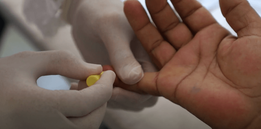 Brasil desenvolve novo teste rápido para o diagnóstico da sífilis